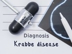 Krabbe disease causes degeneration of neurons directly: Study(Unsplash) Krabbe disease causes degeneration of neurons directly: Study(Unsplash)