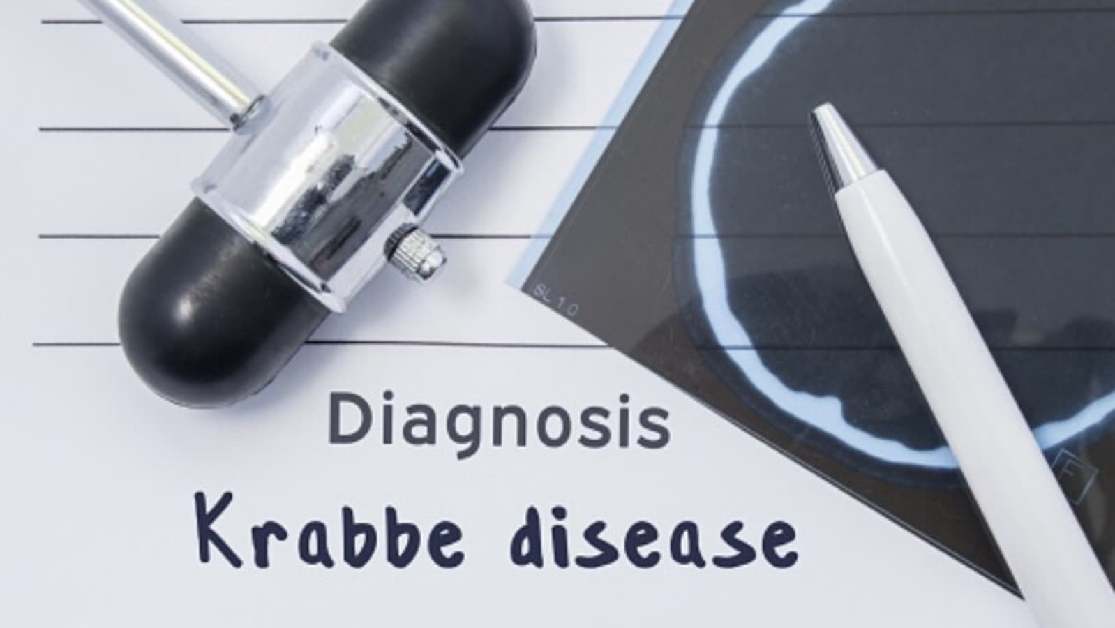 Krabbe disease causes degeneration of neurons directly: Study