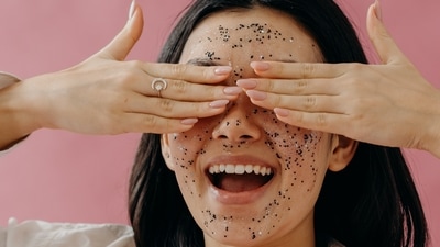 Say ‘goodbye’ to monsoon skin woes with these beauty tips to get a clear face&nbsp; (Polina Kovaleva)