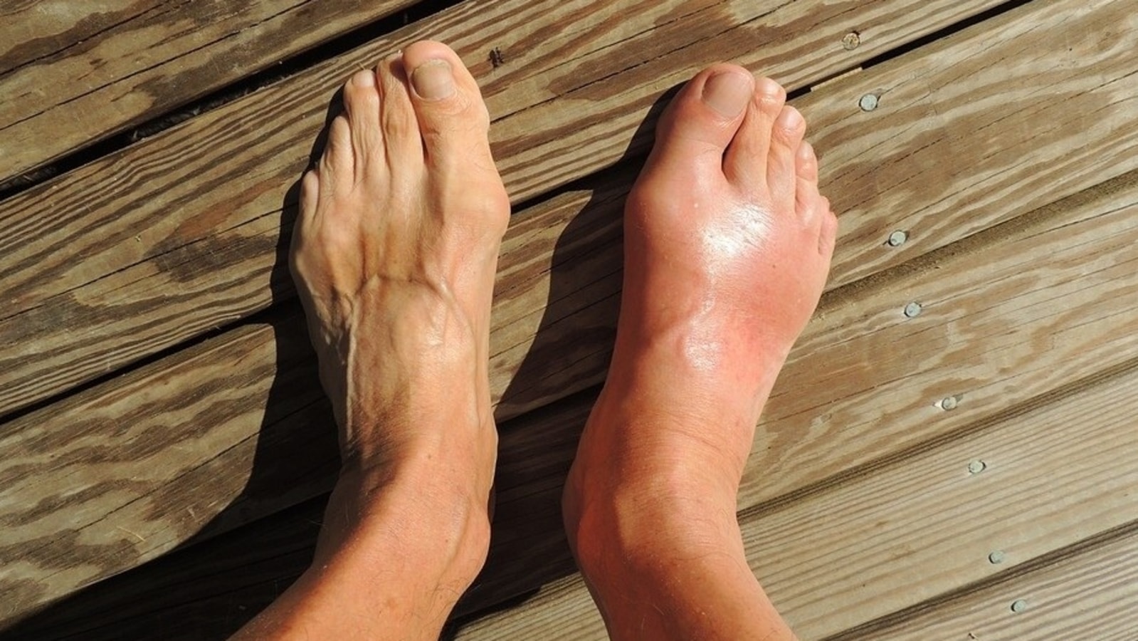 Foot Exercises and Stretches for Arthritis Foot Pain