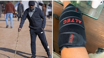 Vivek Agnihotri has shared about his knee injury. Vivek Agnihotri has shared about his knee injury. 