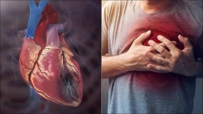 Abnormal heart metabolism linked to sudden cardiac death in future: Study (Twitter/Eqraaam) Abnormal heart metabolism linked to sudden cardiac death in future: Study (Twitter/Eqraaam)