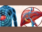 Viral Hepatitis: Causes, symptoms, who is at higher risk, treatment, prevention tips (Twitter/NHPINDIA) Viral Hepatitis: Causes, symptoms, who is at higher risk, treatment, prevention tips (Twitter/NHPINDIA)
