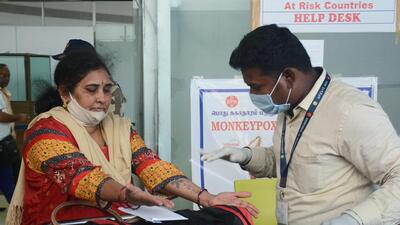 Health workers inspect passengers arriving from high risk countries for monkeypox symptoms, at Chennai International Airport. (ANI) Health workers inspect passengers arriving from high risk countries for monkeypox symptoms, at Chennai International Airport. (ANI)