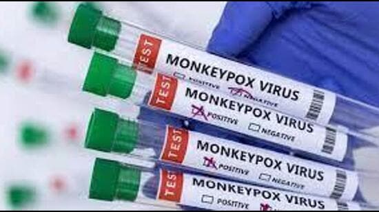 Monkeypox cases usually are reported from African countries including Central African Republic, Democratic Republic of the Congo, Gabon, Liberia, Nigeria, Republic of the Congo, and Sierra Leone. (HT PHOTO.)