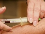 Prior to this study, recently published in The American Journal of Pathology, invasive procedures such as nerve, kidney, or lung biopsy would have been required.(Unsplash) Prior to this study, recently published in The American Journal of Pathology, invasive procedures such as nerve, kidney, or lung biopsy would have been required.(Unsplash)