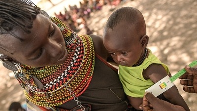 TOPSHOT - A community health worker takes measurements of a boy to gauge his nutritional status, in Purapul village, Loiyangalani area, during World Vision-supported health interventions that help communities tackle malnutrition. &nbsp; (Photo by Simon MAINA / AFP) (AFP)