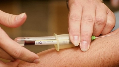 Prior to this study, recently published in The American Journal of Pathology, invasive procedures such as nerve, kidney, or lung biopsy would have been required. (Unsplash) Prior to this study, recently published in The American Journal of Pathology, invasive procedures such as nerve, kidney, or lung biopsy would have been required. (Unsplash)