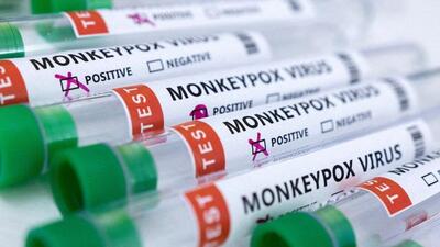 A man from Kerala’s Kollam district, who recently returned from the UAE, was on Thursday confirmed as India’s first case of monkeypox (FILE) A man from Kerala’s Kollam district, who recently returned from the UAE, was on Thursday confirmed as India’s first case of monkeypox (FILE)