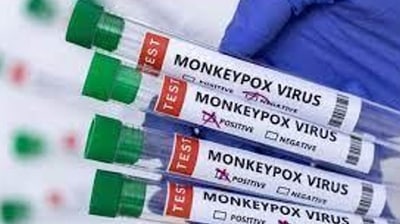 Monkeypox cases were usually reported from African countries including Central African Republic, Democratic Republic of the Congo, Gabon, Liberia, Nigeria, Republic of the Congo, and Sierra Leone. (HT PHOTO.) (HT_PRINT) Monkeypox cases were usually reported from African countries including Central African Republic, Democratic Republic of the Congo, Gabon, Liberia, Nigeria, Republic of the Congo, and Sierra Leone. (HT PHOTO.) (HT_PRINT)