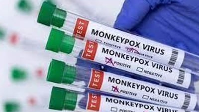 Monkeypox cases were usually reported from African countries including Central African Republic, Democratic Republic of the Congo, Gabon, Liberia, Nigeria, Republic of the Congo, and Sierra Leone. (HT PHOTO.) (HT_PRINT) Monkeypox cases were usually reported from African countries including Central African Republic, Democratic Republic of the Congo, Gabon, Liberia, Nigeria, Republic of the Congo, and Sierra Leone. (HT PHOTO.) (HT_PRINT)