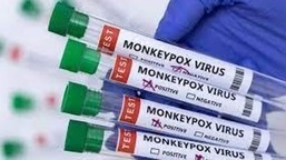 Os nova-iorquinos fazem filas em longas filas para a vacina contra a varíola dos macacos em meio ao surto.  (FOTO HT.)