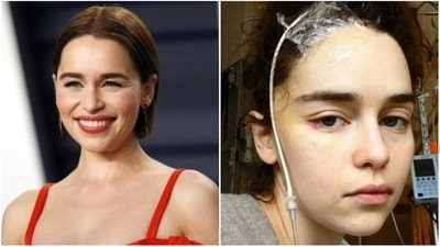 Emilia Clarke speaks about her two brain aneurysms. Emilia Clarke speaks about her two brain aneurysms.