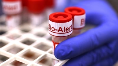 Top of a swab specimen containing Monkeypox virus is labeled "Bio Alert at the UW Medicine Virology Laboratory in Seattle, Washington, US. (Credit: Karen Ducey/Getty Images/AFP) (AFP)