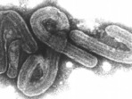 The Marburg virus is one of the most dangerous in the world, with symptoms similar to those observed in Ebola patients(Bernhard-Nocht-Institut/Bni/dpa/picture alliance) The Marburg virus is one of the most dangerous in the world, with symptoms similar to those observed in Ebola patients(Bernhard-Nocht-Institut/Bni/dpa/picture alliance)