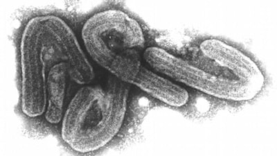 The Marburg virus is one of the most dangerous in the world, with symptoms similar to those observed in Ebola patients (Bernhard-Nocht-Institut/Bni/dpa/picture alliance) The Marburg virus is one of the most dangerous in the world, with symptoms similar to those observed in Ebola patients (Bernhard-Nocht-Institut/Bni/dpa/picture alliance)