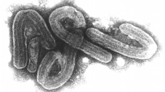 The Marburg virus is one of the most dangerous in the world, with symptoms similar to those observed in Ebola patients(Bernhard-Nocht-Institut/Bni/dpa/picture alliance)