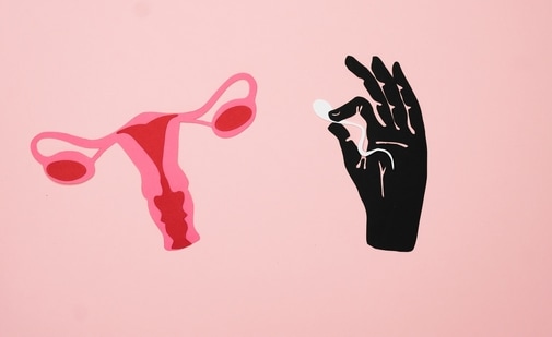 Overcoming Female Causes of Infertility - Bridge Clinic
