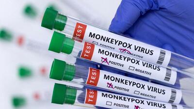 In the wake of confirmed cases of Monkeypox disease in neighbouring Kerala, the Karnataka government has decided to speed up surveillance activities and keep a strong vigil in the state. (REUTERS) In the wake of confirmed cases of Monkeypox disease in neighbouring Kerala, the Karnataka government has decided to speed up surveillance activities and keep a strong vigil in the state. (REUTERS)