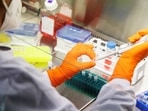 Monkeypox: An employee of the vaccine company Bavarian Nordic works in a laboratory of the company in Martinsried near Munich, Germany, The company, headquartered in Denmark, is the only one in the world to have approval for a smallpox vaccine called Jynneos in the U.S. and Imvanex in Europe, which is also effective against monkeypox.&nbsp;
