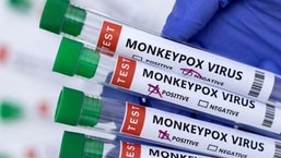 So far, 3 cases of monkeypox have been reported in India.  (Reuters)