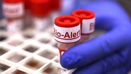 A parte superior de uma amostra de zaragatoa contendo o vírus Monkeypox é rotulada "Bio Alert no Laboratório de Virologia de Medicina da UW em Seattle, Washington, EUA. 