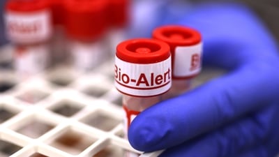 Top of a swab specimen containing Monkeypox virus is labeled "Bio Alert at the UW Medicine Virology Laboratory in Seattle, Washington, US. (Karen Ducey/Getty Images/AFP) Top of a swab specimen containing Monkeypox virus is labeled "Bio Alert at the UW Medicine Virology Laboratory in Seattle, Washington, US. (Karen Ducey/Getty Images/AFP)