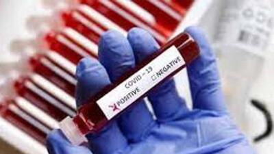The number of active Covid patients in Chandigarh is 674, followed by 632 in Mohali and 344 in Panchkula. (HT File)
