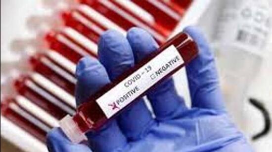The number of active Covid patients in Chandigarh is 674, followed by 632 in Mohali and 344 in Panchkula. (HT File)