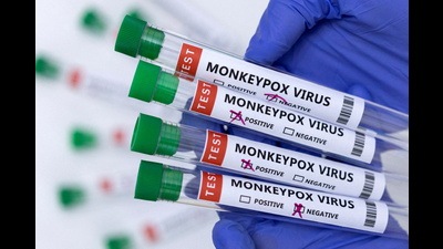 The World Health Organisation (WHO) declared monkeypox a global health emergency on Saturday. (REPRESENTATIVE IMAGE) The World Health Organisation (WHO) declared monkeypox a global health emergency on Saturday. (REPRESENTATIVE IMAGE)