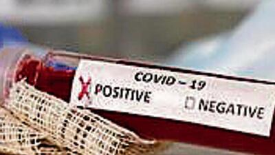 On Sunday, Chandigarh had the highest Covid daily positivity rate at 9.9%, while 8.6% was recorded in Panchkula and 7.9 in Mohali. (HT File)