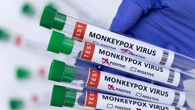 4 Monkeypox cases have been reported from India so far. (REUTERS) 4 Monkeypox cases have been reported from India so far. (REUTERS)