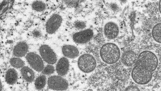 An electron microscopic (EM) image shows mature, oval-shaped monkeypox virus particles as well as crescents and spherical particles of immature virions, obtained from a clinical human skin sample associated with the 2003 prairie dog outbreak. (File image)(VIA REUTERS)