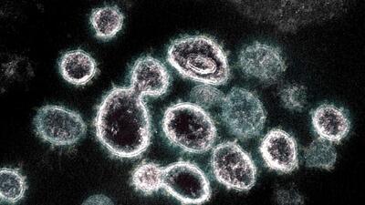 As many as 66 persons also tested positive for Covid in Ludhiana in 24 hours, as per the health bulletin released on Tuesday. (AFP FILE)