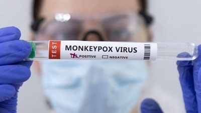 The World Health Organisation (WHO) has declared monkey pox as a global health emergency. (REUTERS) The World Health Organisation (WHO) has declared monkey pox as a global health emergency. (REUTERS)