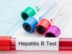 Hepatitis is essentially inflammation of the liver, which may be caused by an infection or an injury. Hepatitis is essentially inflammation of the liver, which may be caused by an infection or an injury.
