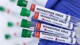 A Organização Mundial da Saúde (OMS) declarou a varíola dos macacos uma emergência de saúde global no sábado.  (IMAGEM REPRESENTATIVA)