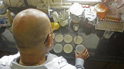 A scientist inspects cholera samples in eastern India. (HT File Photo)