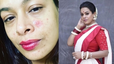 Iman Chakraborty is suffering from PCOD and endometriosis. Iman Chakraborty is suffering from PCOD and endometriosis.