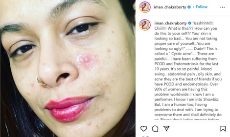 Iman Chakraborty's Instagram post.