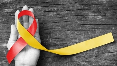 Usually, childhood hepatitis is caused by an infection from one of the hepatitis viruses (Shutterstock) Usually, childhood hepatitis is caused by an infection from one of the hepatitis viruses (Shutterstock)