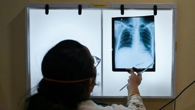 New effective therapeutic approaches to treat tuberculosis: Research