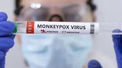 The patient’s reports came back negative on Thursday morning. (File image) The patient’s reports came back negative on Thursday morning. (File image)
