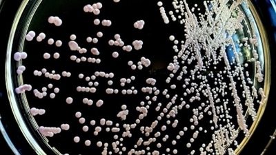Even though a little amount of yeast is healthy for the body, large amounts can result in gas, bloating, mouth sores, bad breath and itchy rashes. (Unsplash)