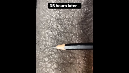 The image, taken from the viral Instagram video, shows the artist's hyper-realistic drawing of a human finger.(Instagram/@eteportraits)