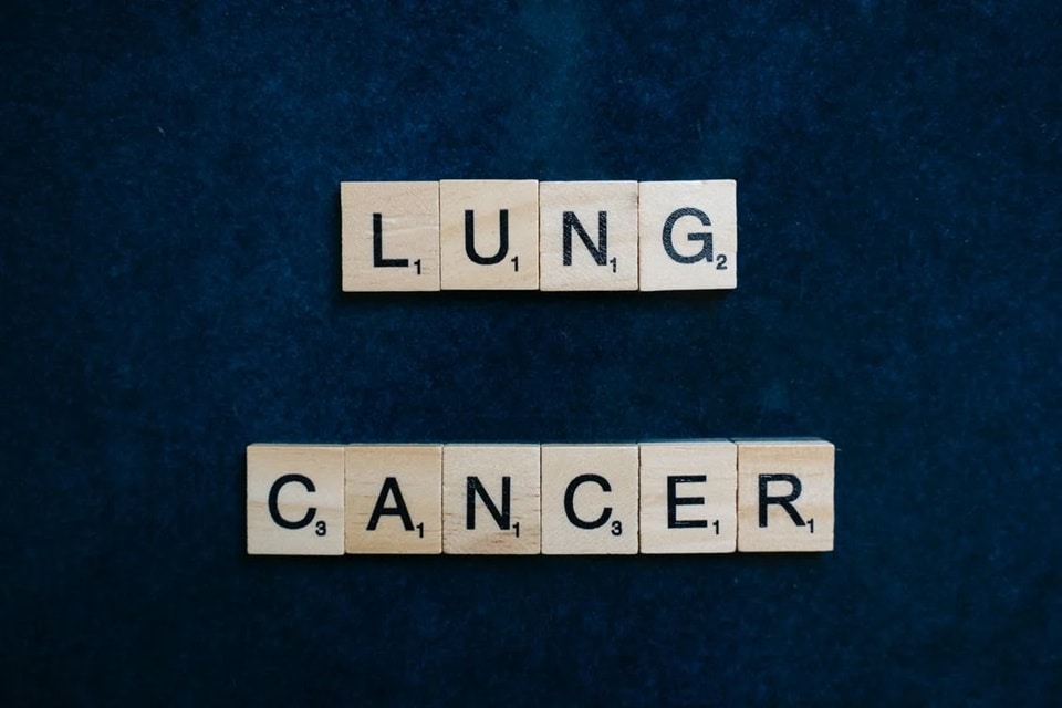 World Lung Cancer Day 2022: Quitting smoking can reduce your risk of lung cancer by 30 to 50% over the next 10 years. (Pexels) World Lung Cancer Day 2022: Quitting smoking can reduce your risk of lung cancer by 30 to 50% over the next 10 years. (Pexels)