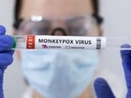 Monkeypox can cause a range of symptoms, including fever, rash, and swollen lymph nodes, which can be easily confused with symptoms of other illnesses, such as chickenpox, measles, and bacterial skin infections. (REUTERS) Monkeypox can cause a range of symptoms, including fever, rash, and swollen lymph nodes, which can be easily confused with symptoms of other illnesses, such as chickenpox, measles, and bacterial skin infections. (REUTERS)