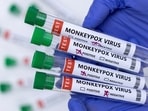 Delhi reported its second monkeypox case.(Representative image) Delhi reported its second monkeypox case.(Representative image)