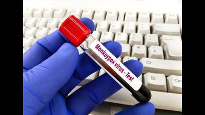 The samples have been sent to the All India Institute of Medical Sciences, New Delhi. (HT Photo) The samples have been sent to the All India Institute of Medical Sciences, New Delhi. (HT Photo)