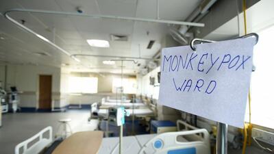 A monkeypox ward at a hospital in Noida. (Hindustan Times) A monkeypox ward at a hospital in Noida. (Hindustan Times)